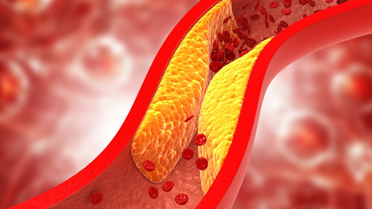 High Cholesterol: How Walking Helps in Managing Unhealthy Fats